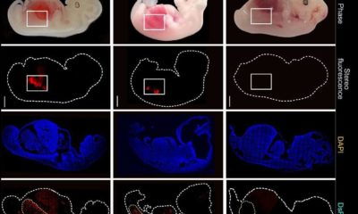 Crean riñones humanizados en embriones de cerdo durante 28 días