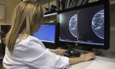 conselleria elimina segunda mamografia