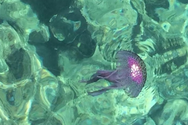 Nunca hagas esto si te pica una medusa