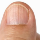 ¿Producen cáncer los secadores de esmaltes de uñas de luz UV?