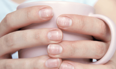 ¿Qué indican las manchas blancas en las uñas?