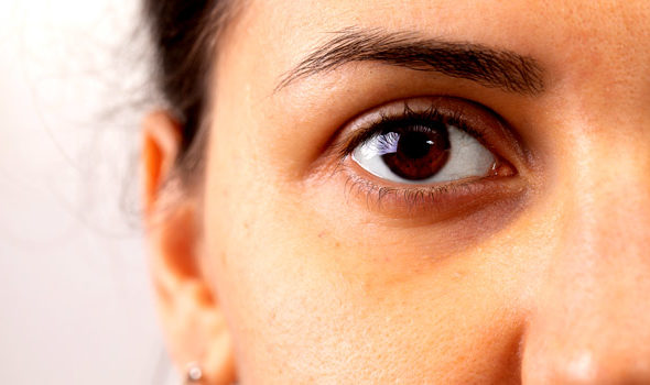 ¿Qué indican las ojeras negras?