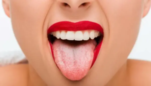 Lengua color salud problemas