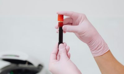 análisis detección esclerosis múltiple